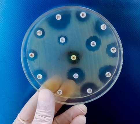 Persister Cells and Differences from Other Cell Types